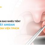 Cắt Amidan bao nhiêu tiền? Chi phí cắt Amidan tại 5 địa chỉ uy tín TPHCM