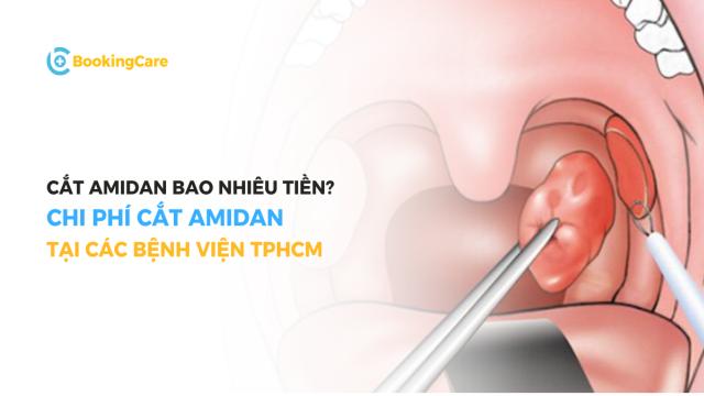 Chi phí cắt amidan bao nhiêu tiền?