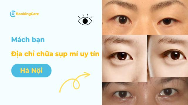 5 địa chỉ chữa sụp mí mắt tại Hà Nội uy tín