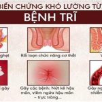 Top 19 Địa chỉ phòng khám chữa bệnh trĩ ở đâu tốt nhất Hà Nội