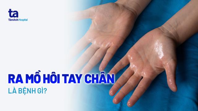 ra mồ hôi tay chân