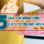 15 địa chỉ bệnh viện cắt tuyến mồ hôi nách tốt tại Hà Nội