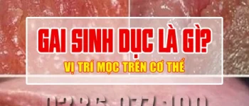 Gai sinh dục là gì, thường mọc ở đâu trên cơ thể?