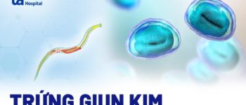 Trứng giun kim bao lâu thì nở? Hình ảnh và đặc điểm nhận dạng