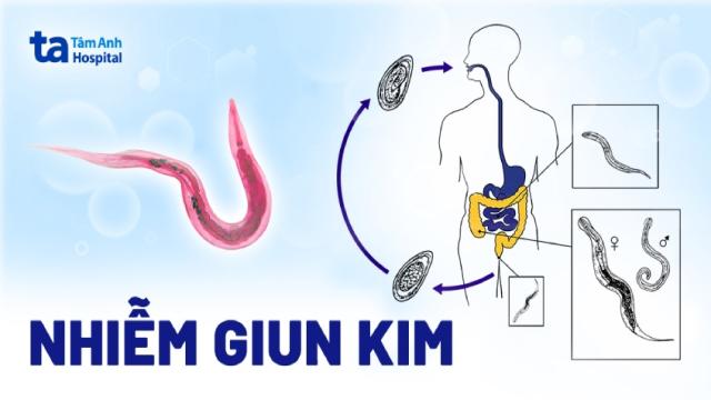 nhiễm giun kim