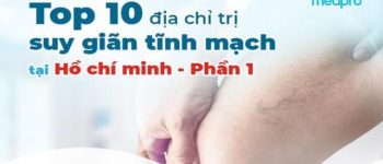 Top 10 Địa Chỉ Điều Trị Suy Giãn Tĩnh Mạch uy tín và dứt điểm tại TP HCM - Phần 1