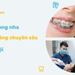 Top 6 địa chỉ niềng răng chuyên sâu uy tín tại Hà Nội