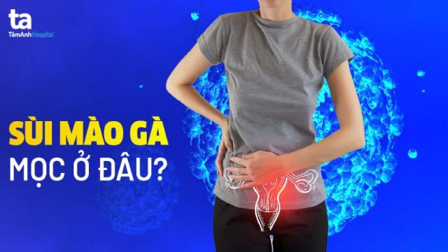 sùi mào gà mọc ở đâu