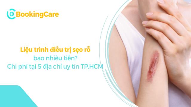 Liệu trình điều trị sẹo rỗ bao nhiêu tiền? Chi phí tại 5 địa chỉ uy tín TPHCM