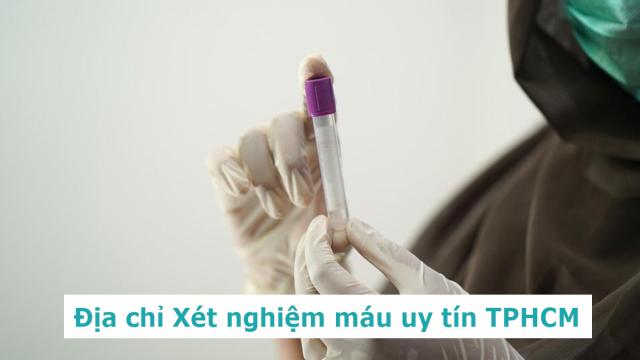 Địa chỉ xét nghiệm máu tổng quát uy tín TPHCM