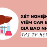 Xét nghiệm Viêm gan B giá bao nhiêu? Bảng giá một số địa chỉ tại TP.HCM