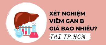 Xét nghiệm Viêm gan B giá bao nhiêu? Bảng giá một số địa chỉ tại TP.HCM