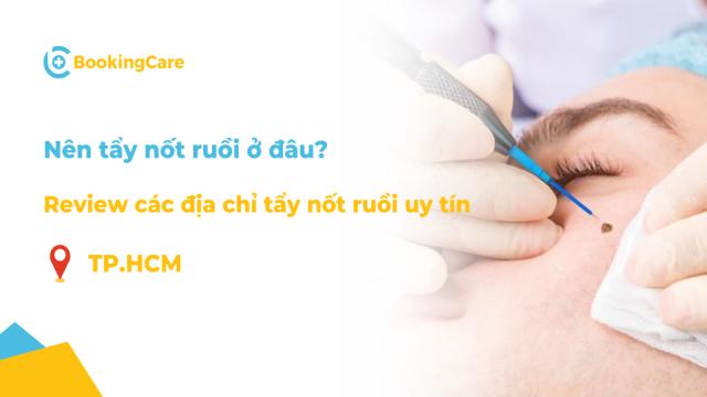 Review các địa chỉ tẩy nốt ruồi uy tín TPHCM