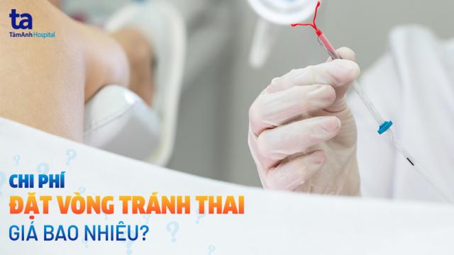 chi phí đặt vòng tránh thai bao nhiêu tiền