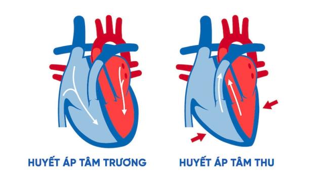 Huyết áp tâm thu là gì? Biểu hiện và cách phòng tránh-1