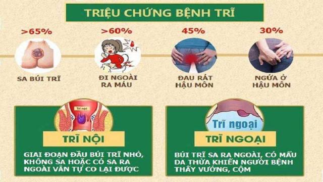 Một số triệu chứng gợi ý mắc bệnh trĩ