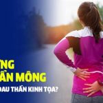 Đau lưng dưới gần mông là bệnh gì? Chẩn đoán và điều trị