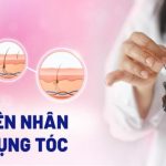 Rụng tóc là gì? 15 Nguyên nhân và dấu hiệu thường gặp